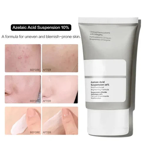 The Ordinary Vitamin C Suspension 30% in Silicone – Brightening Face Cream