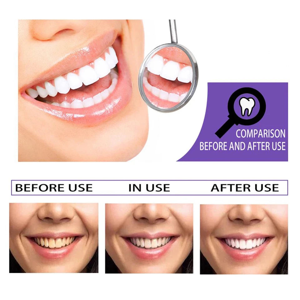 HiSmile Teeth Whitening Cream – Professional Whitening Formula