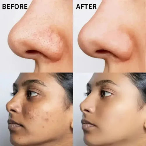 The Ordinary Hyaluronic Acid 2% + B5 – Deep Hydration Serum