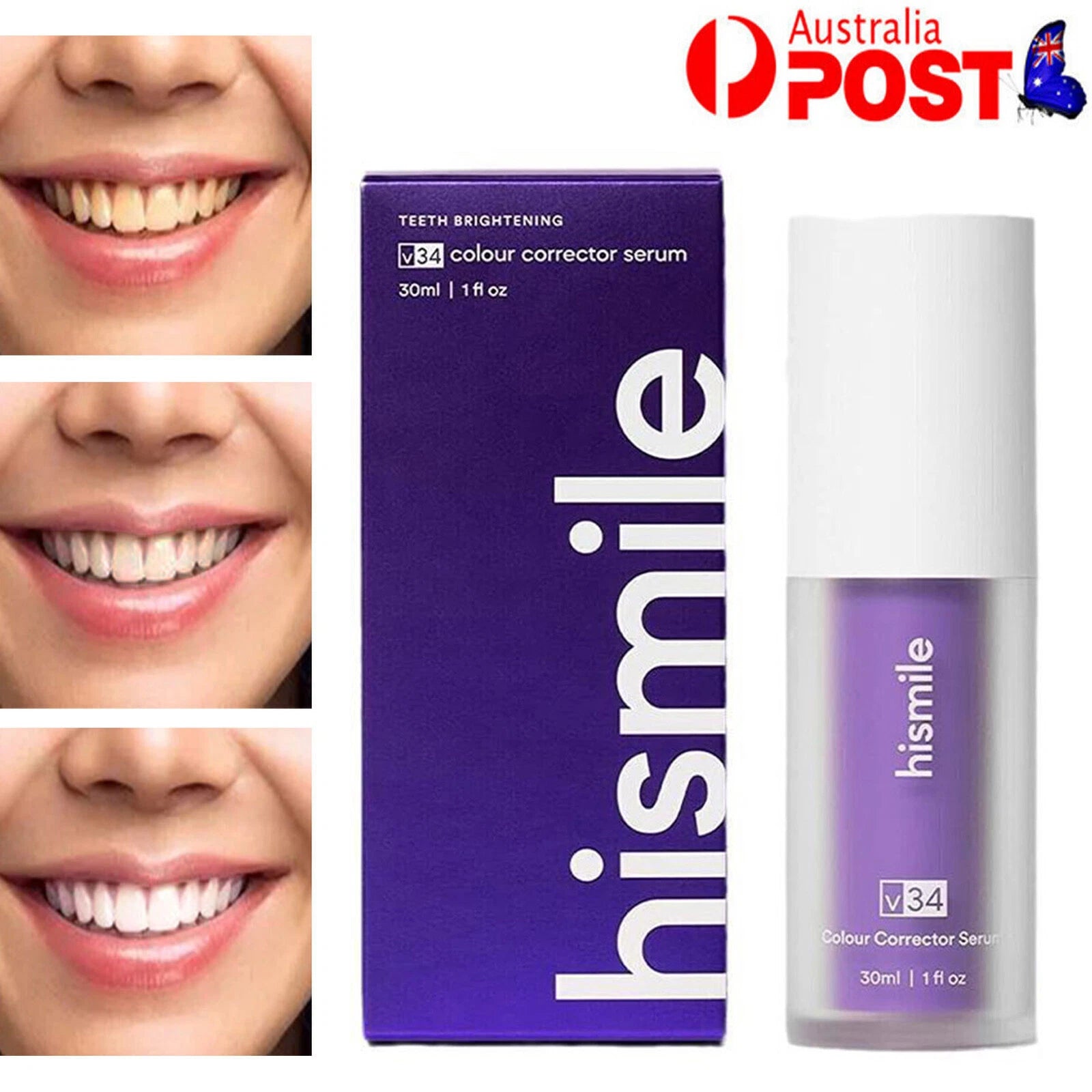 HiSmile Teeth Whitening Cream – Professional Whitening Formula