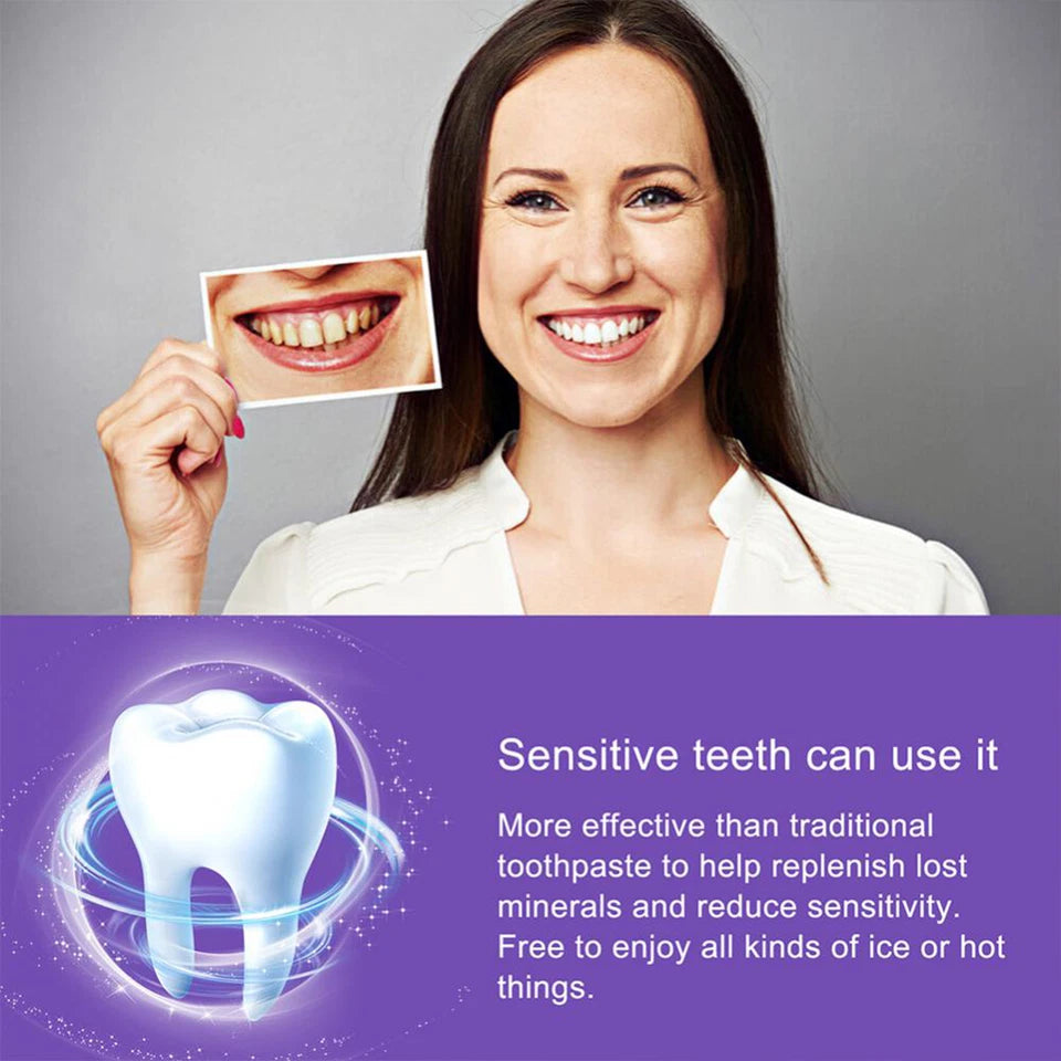 HiSmile Teeth Whitening Cream – Professional Whitening Formula