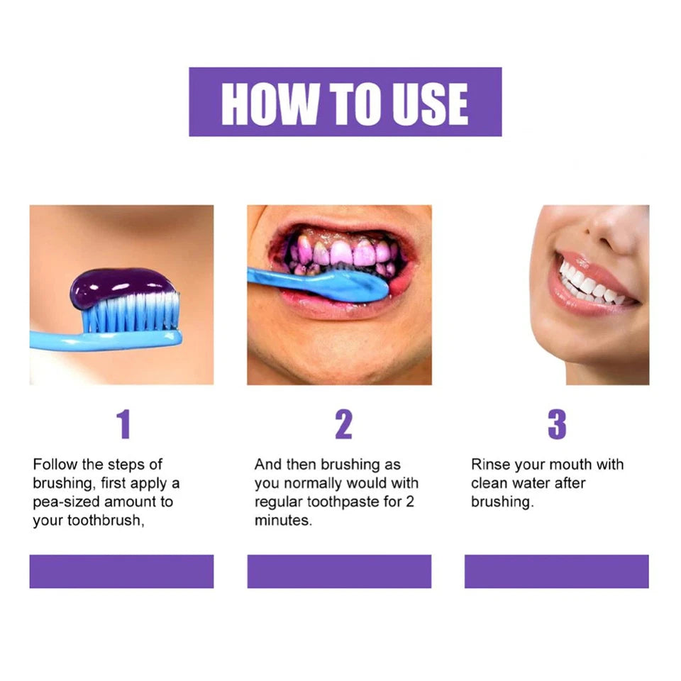 HiSmile Teeth Whitening Cream – Professional Whitening Formula